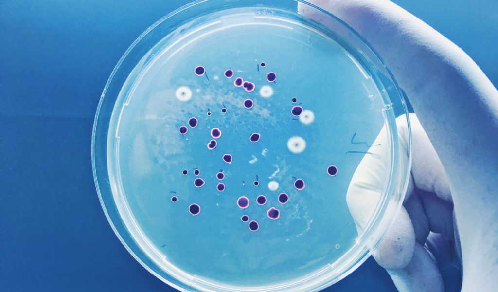 Bacteria Being Looked At In Laboratory